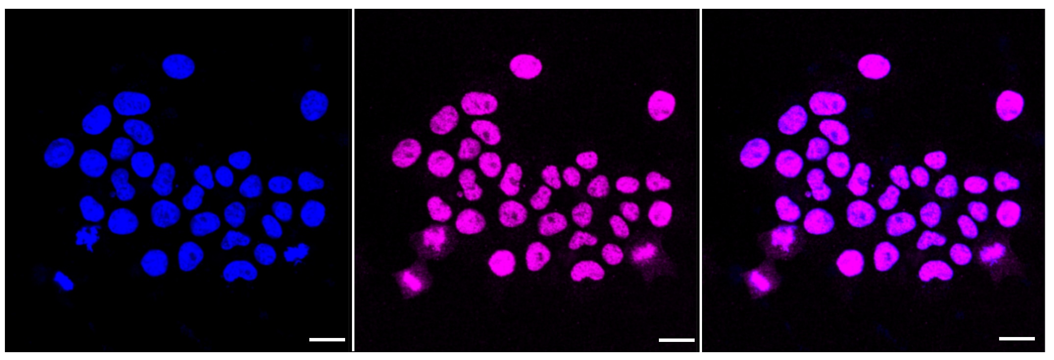 WSTF Antibody (23GB3685)