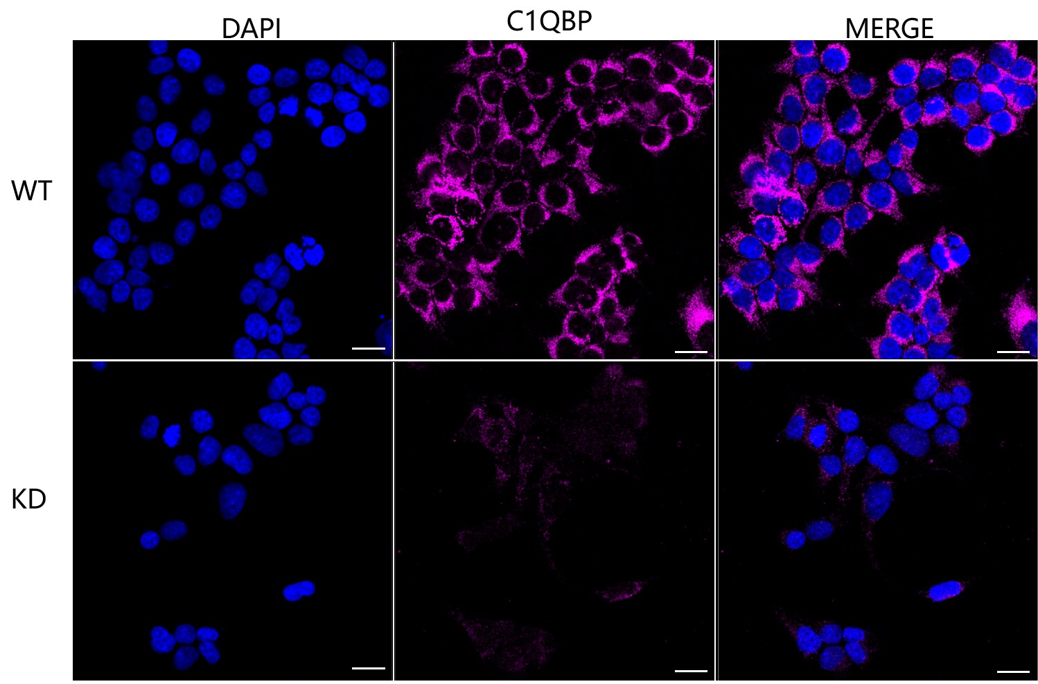 HABP1/C1QBP/GC1q R Antibody (23GB690)