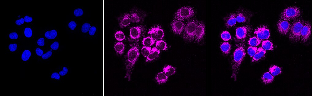 HABP1/C1QBP/GC1q R Antibody (23GB690)