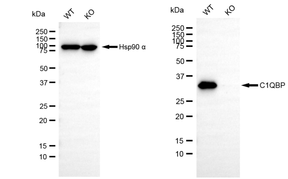 HABP1/C1QBP/GC1q R Antibody (23GB690)