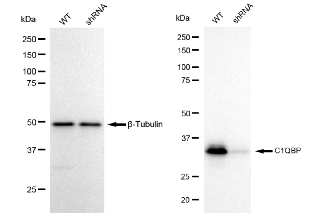HABP1/C1QBP/GC1q R Antibody (23GB690)