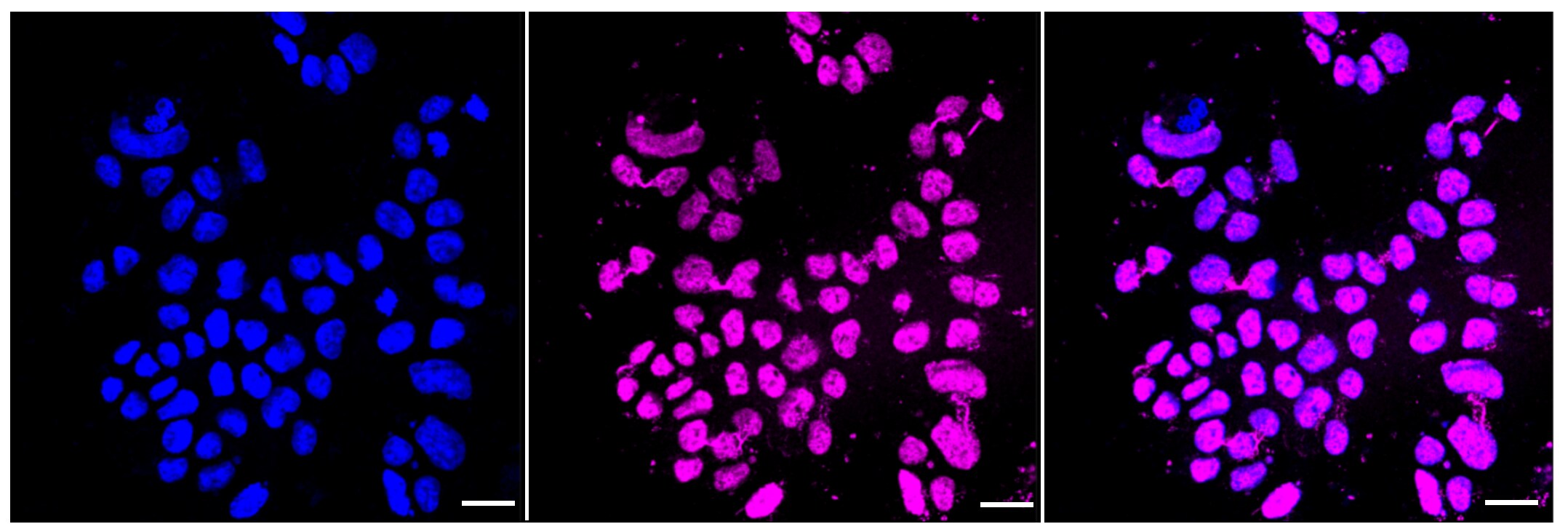 Histone H3 [ac Lys9] Antibody (23GB4440)