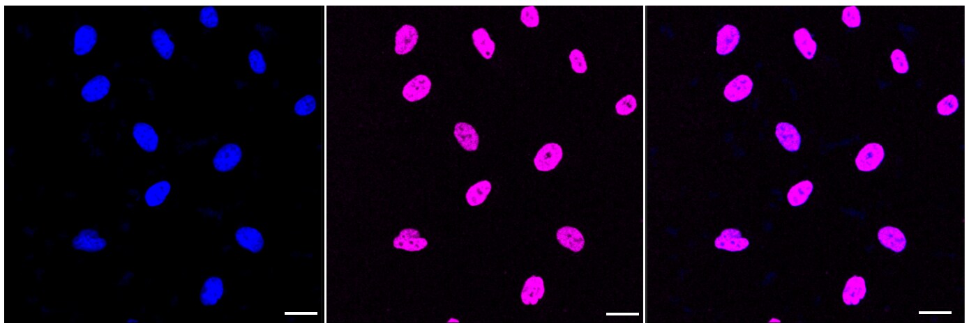 Histone H3 [ac Lys27] Antibody (23GB4480)