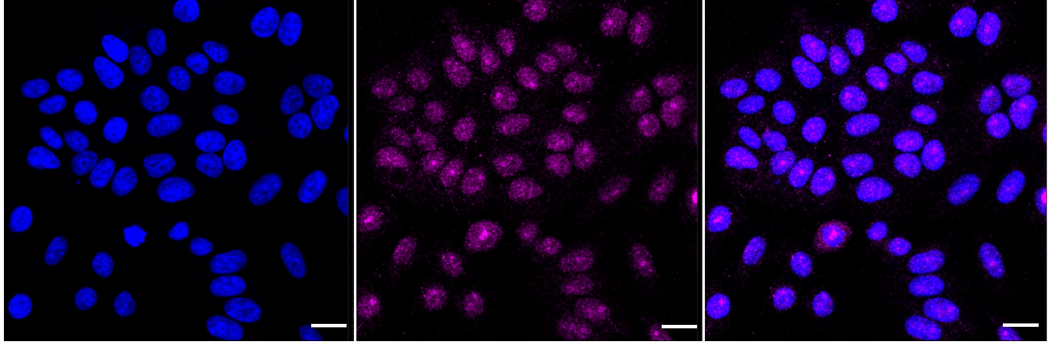 EGFR [p Tyr1173] Antibody (23GB3900)