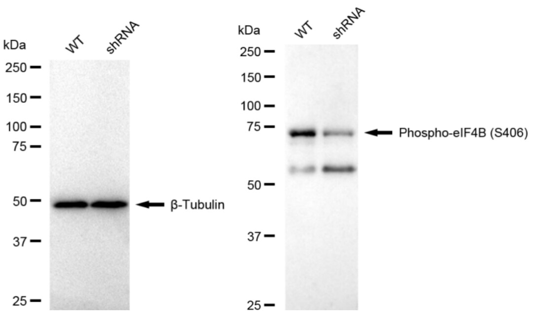 eIF4B [p Ser406] Antibody (23GB3905)