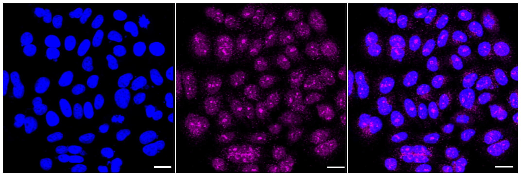 ATP7b Antibody (23GB3945)