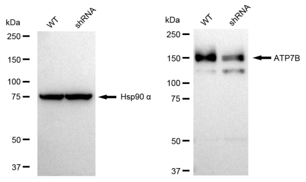 ATP7b Antibody (23GB3945)