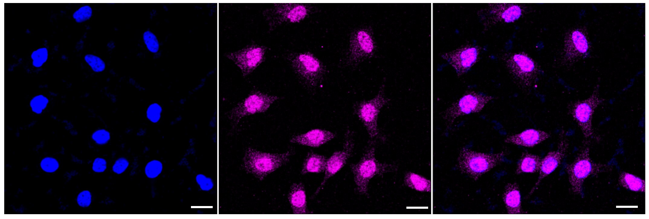IQGAP2 Antibody (23GB4020)