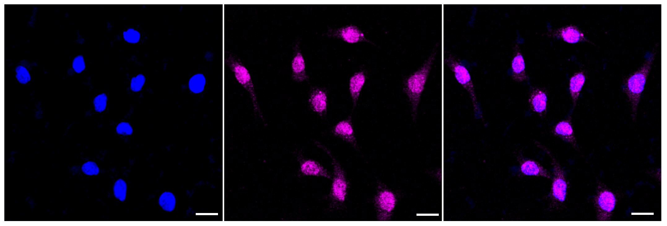 MTH1 Antibody (23GB4060)