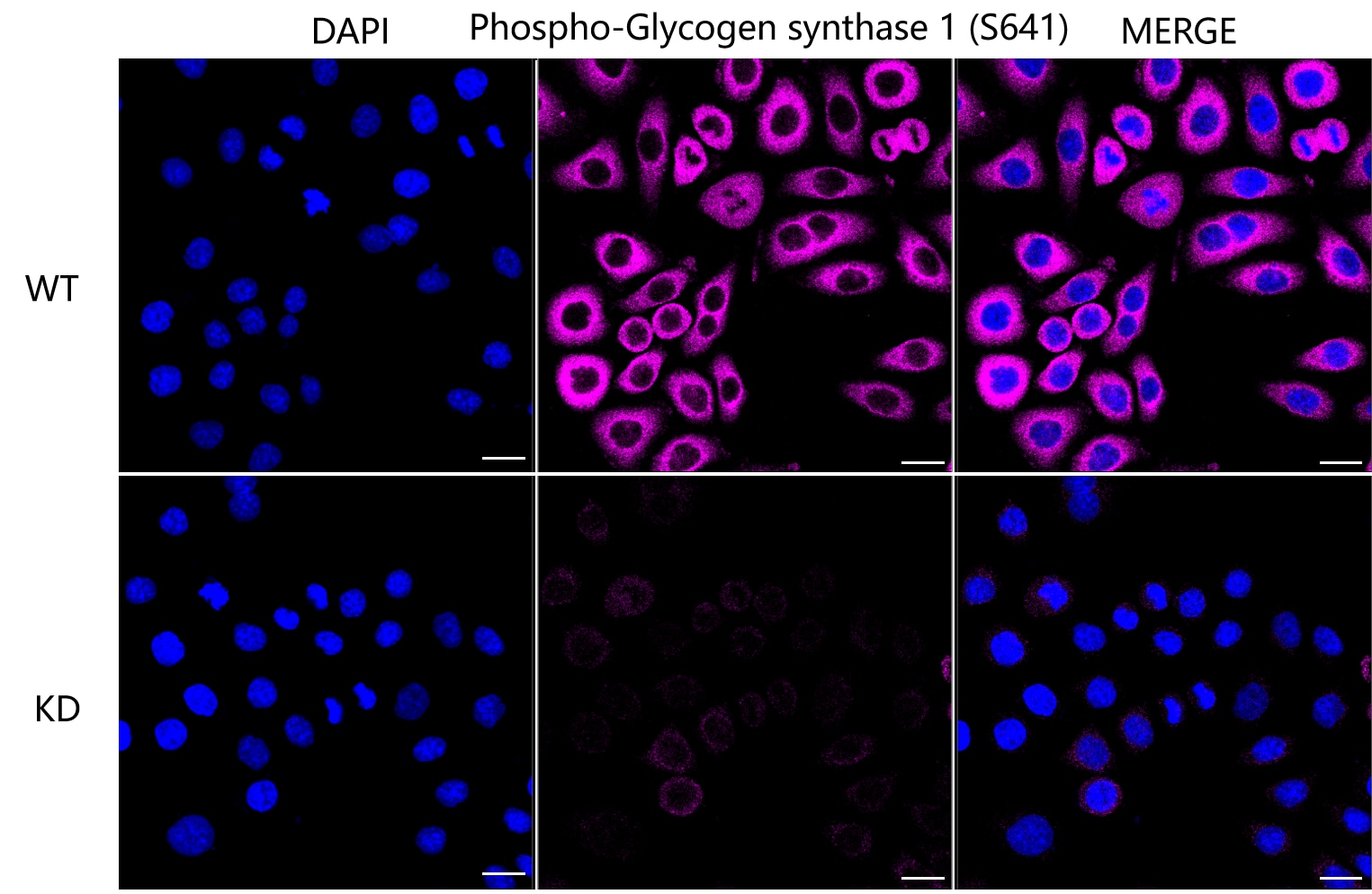 Glycogen Synthase [p Ser641] Antibody (23GB4070)