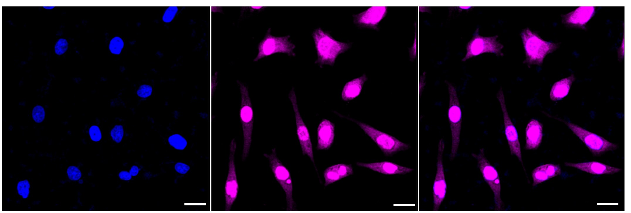 PKC alpha [p Thr638] Antibody (23GB4100)
