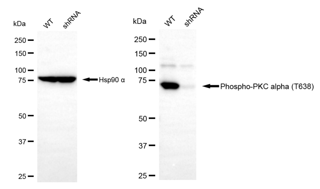 PKC alpha [p Thr638] Antibody (23GB4100)