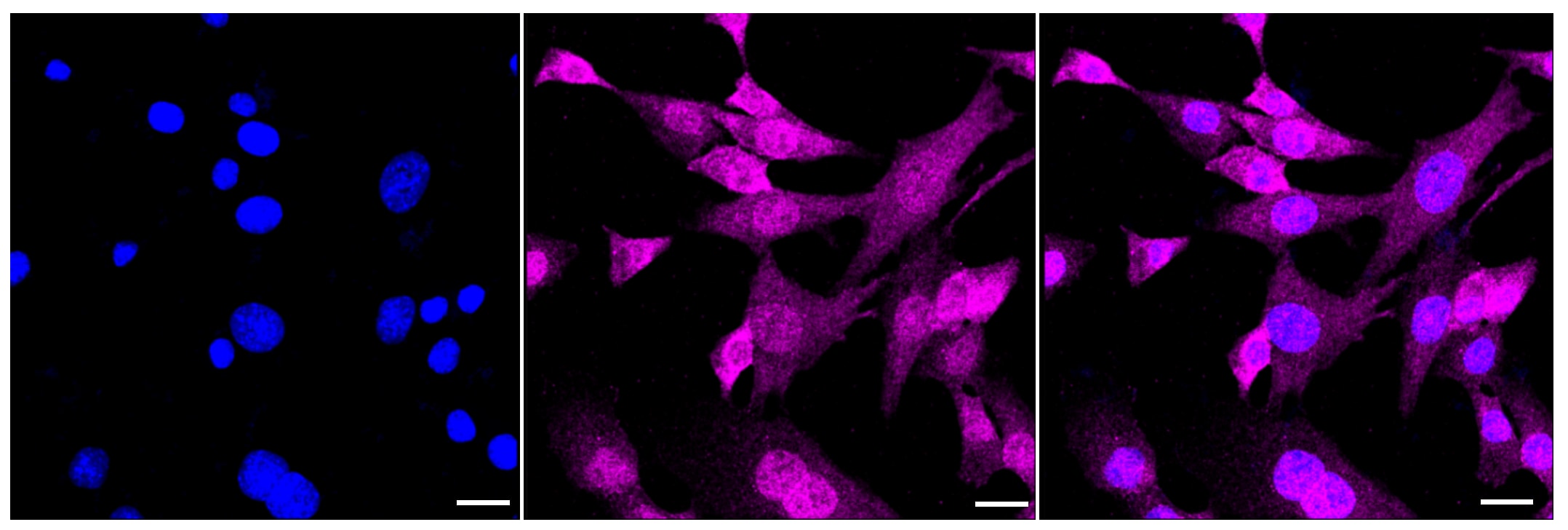 Smad2 [p Ser250] Antibody (23GB4150)