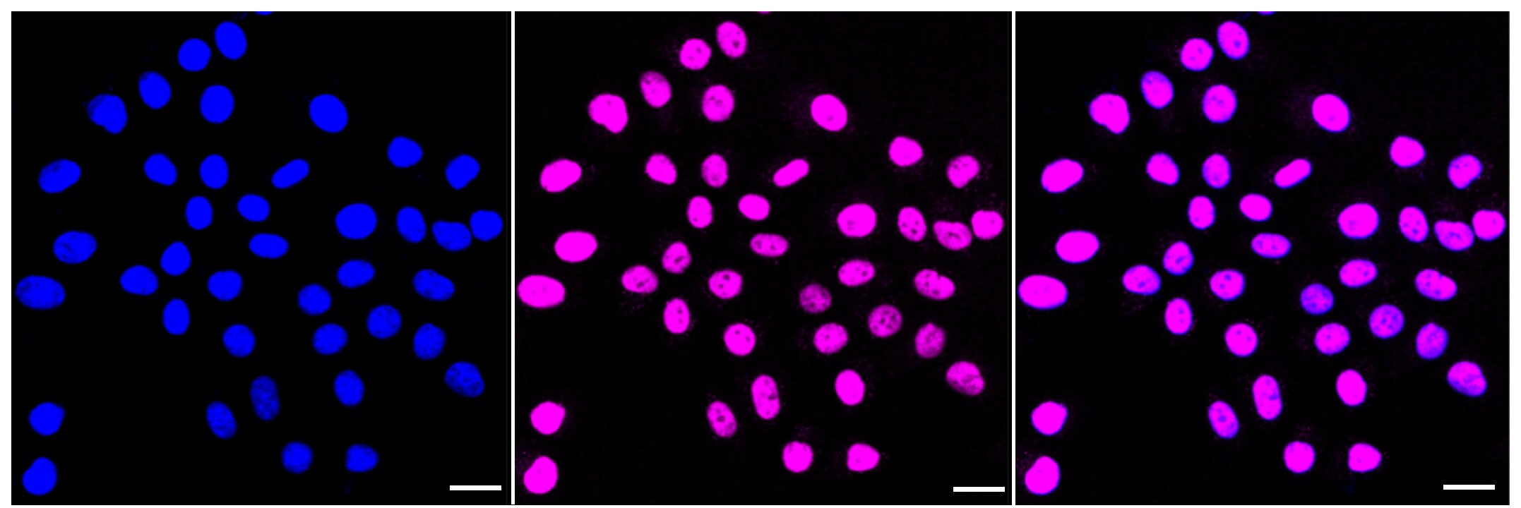 SMARCC1 Antibody (23GB4165)