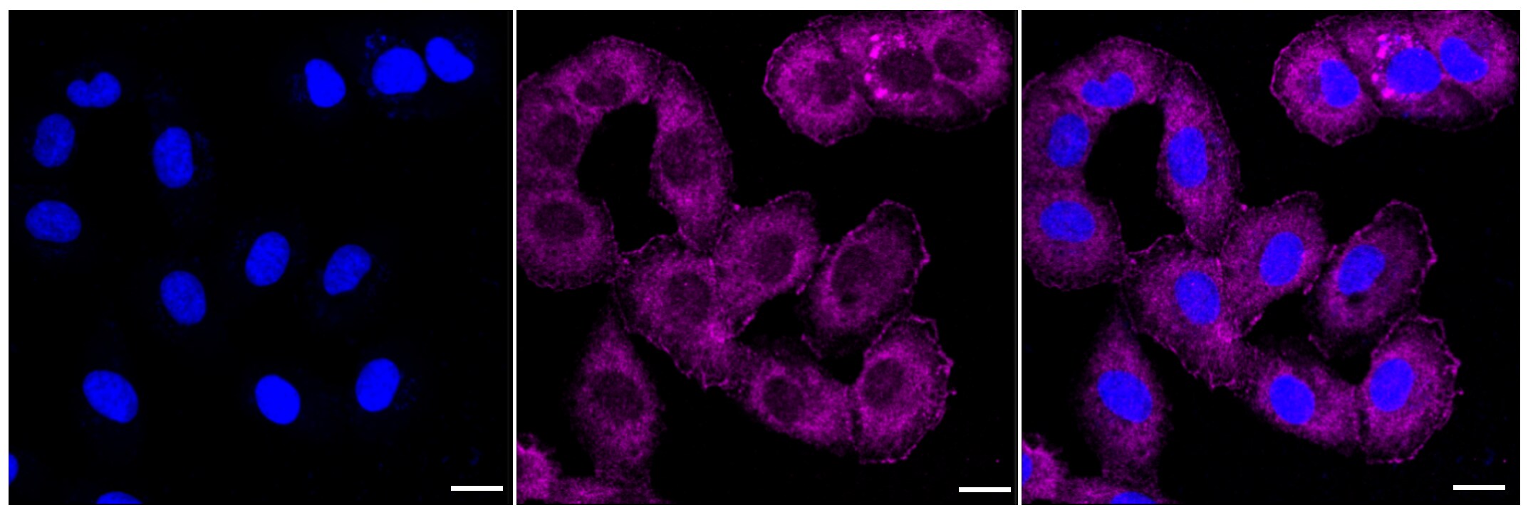 SPINK5 Antibody (23GB4180)