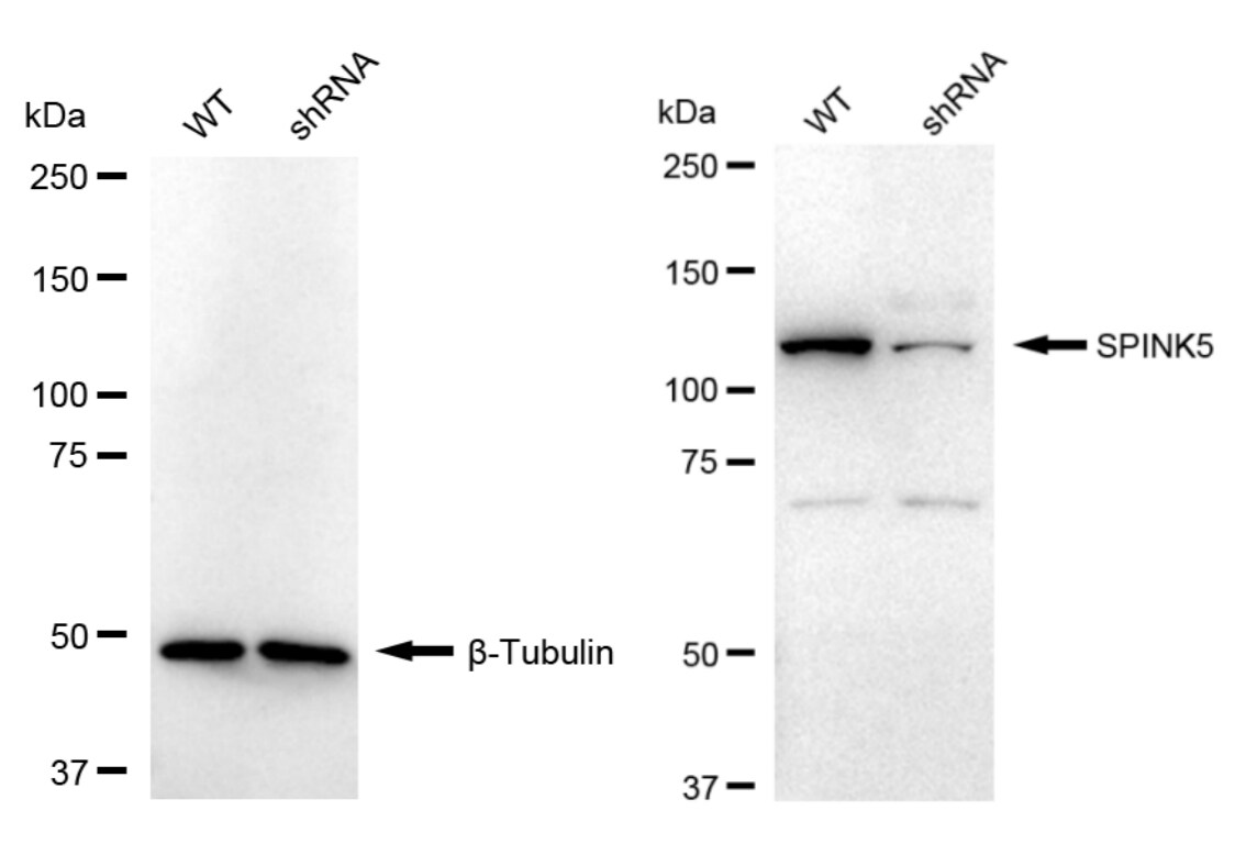 SPINK5 Antibody (23GB4180)