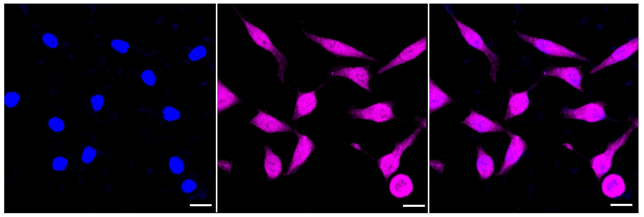 STAT1 Antibody (23GB4185)