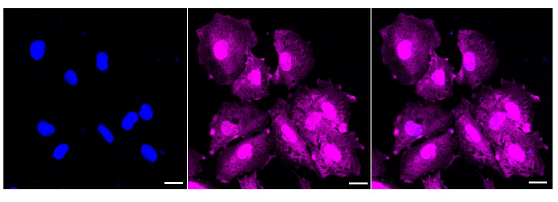 STAT1 Antibody (23GB4195)