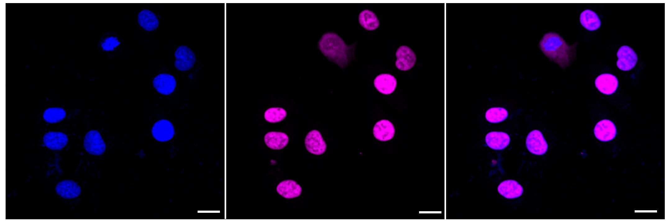 SUPT5H Antibody (23GB4220)