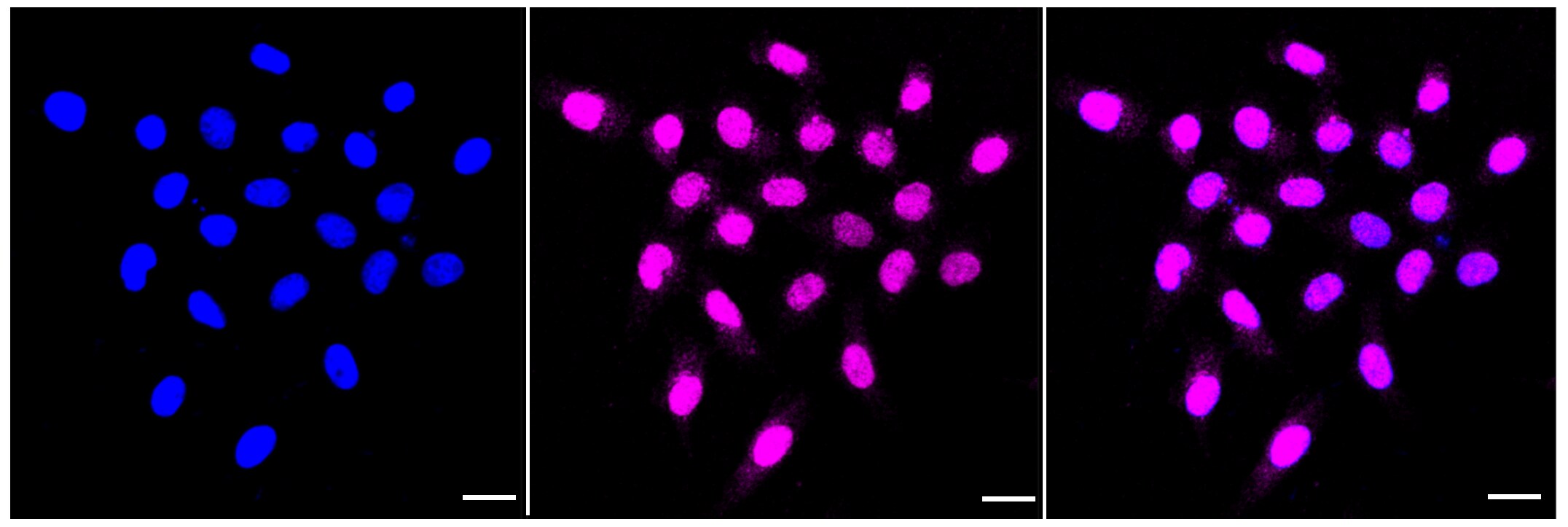 TIF1 alpha Antibody (23GB4235)