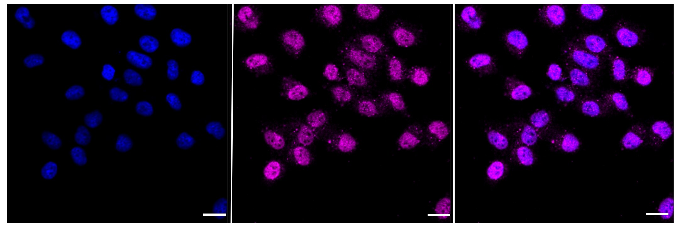 EMMPRIN/CD147 Antibody (23GB1400)