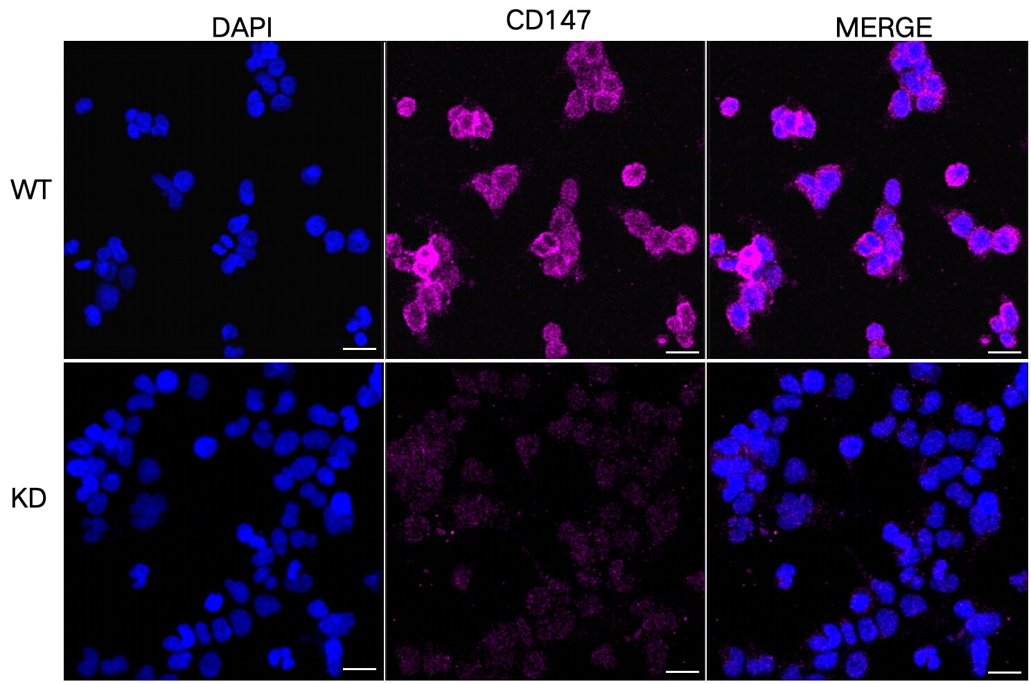 EMMPRIN/CD147 Antibody (23GB1400)