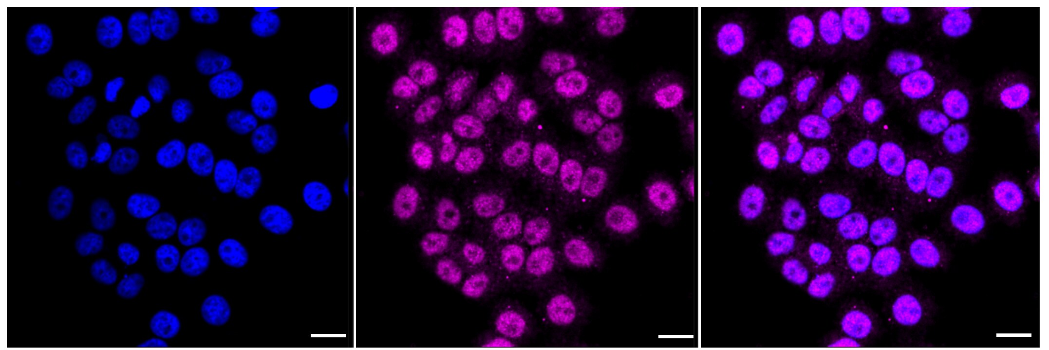ATG5 Antibody (23GB1870)