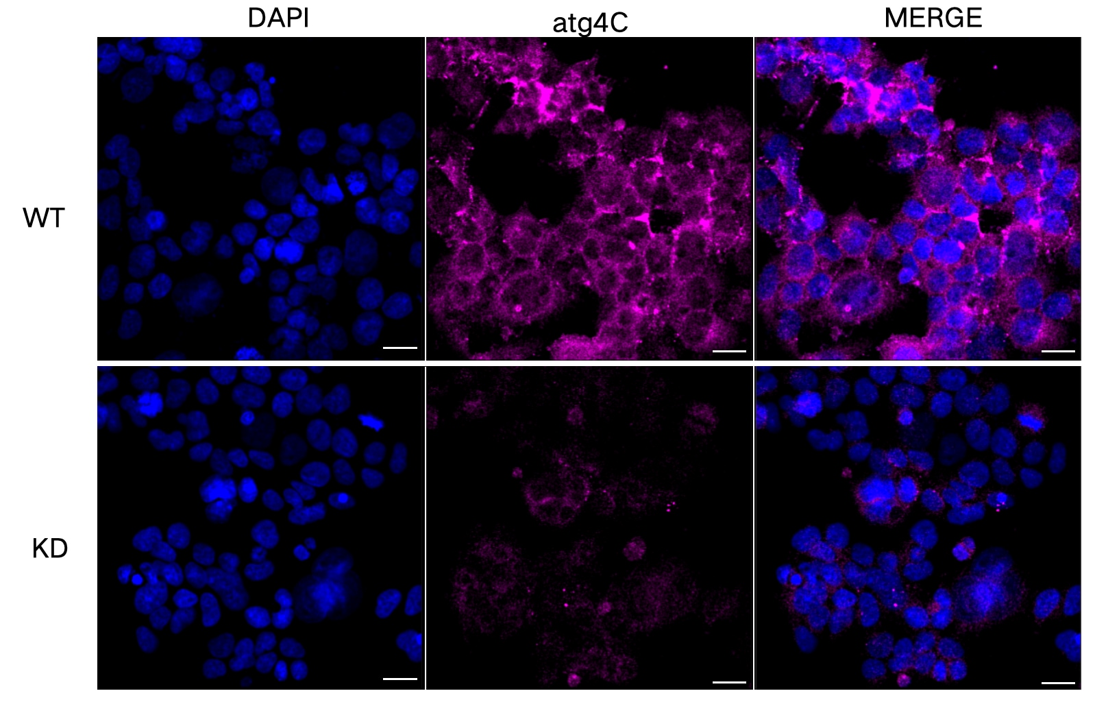 ATG4C Antibody (23GB670)