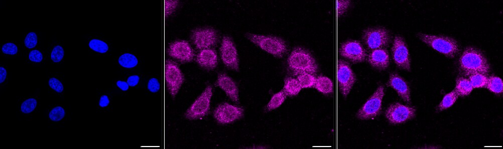 ATG4C Antibody (23GB670)