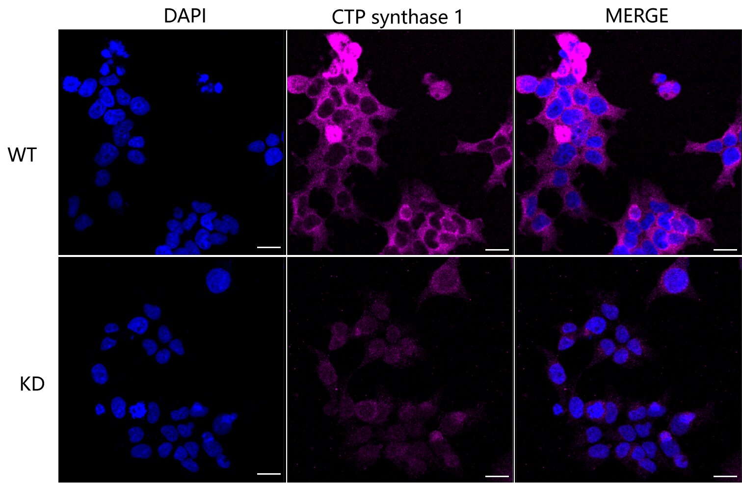 CTP synthase Antibody (23GB1685)