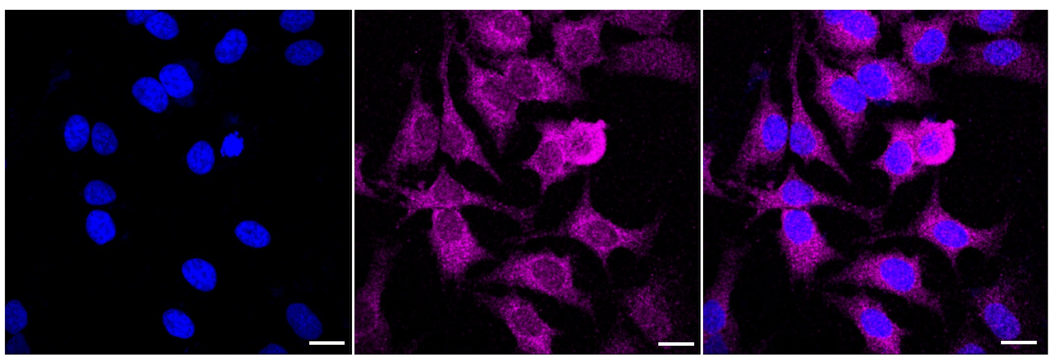 Glutathione Peroxidase 1/GPX1 Antibody (23GB5600)