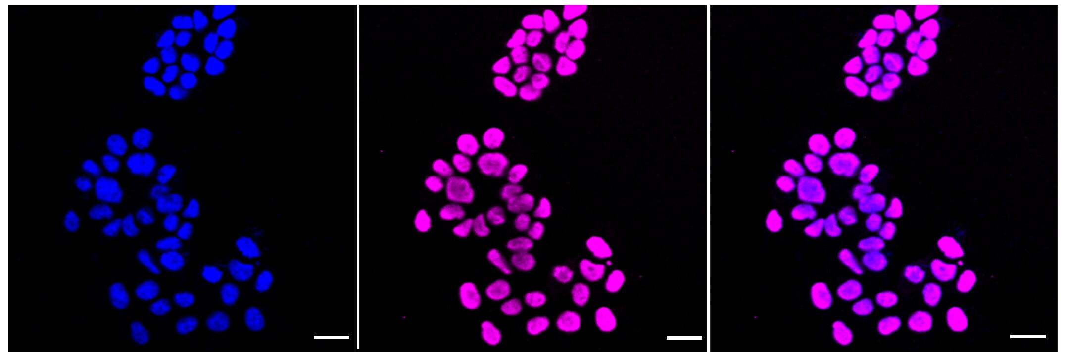 Histone H3 [ac Lys56] Antibody (23GB4395)