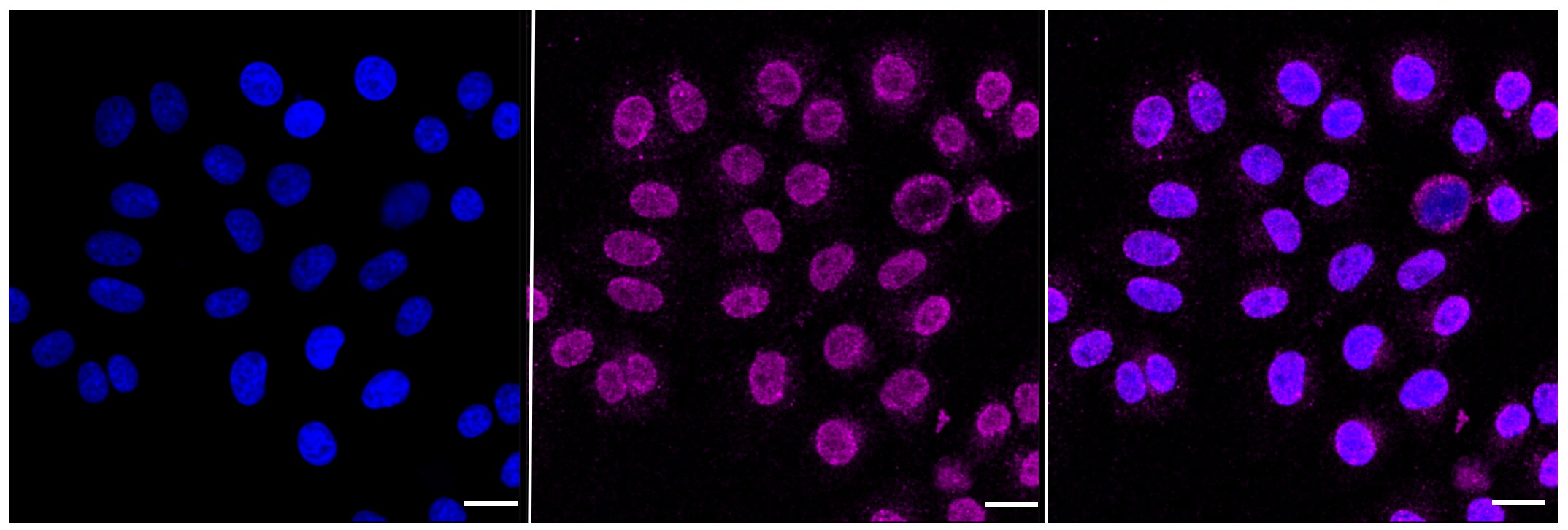 Nicastrin Antibody (23GB1040)
