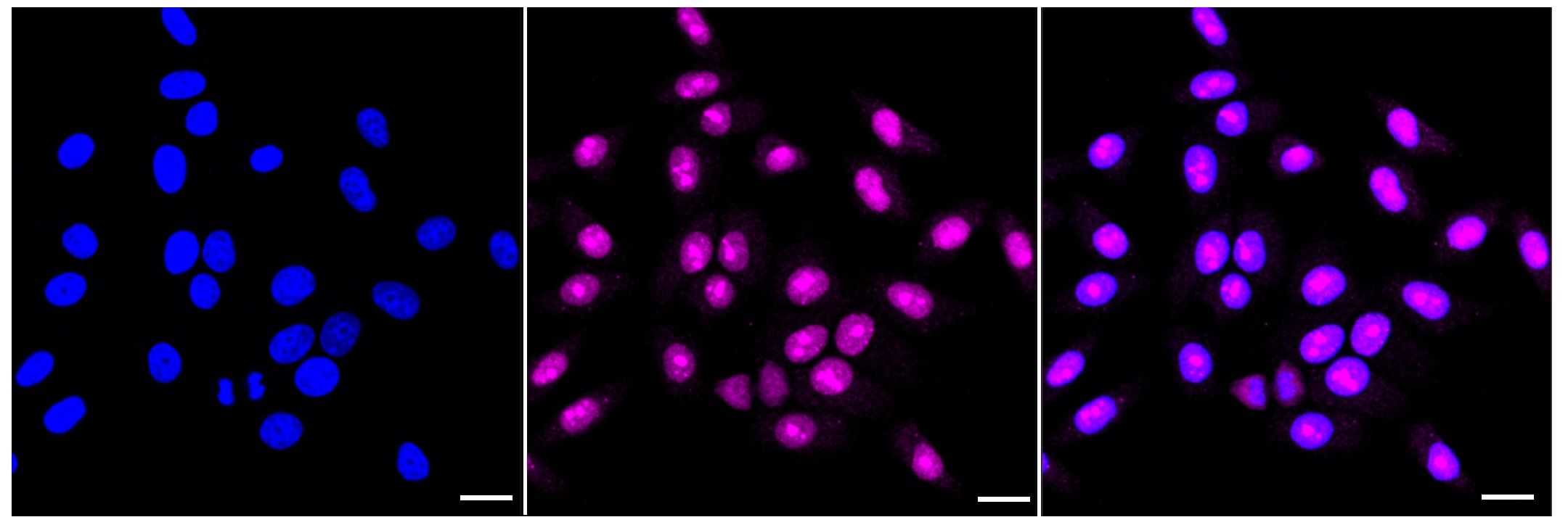 HMGB2 Antibody (23GB4490)