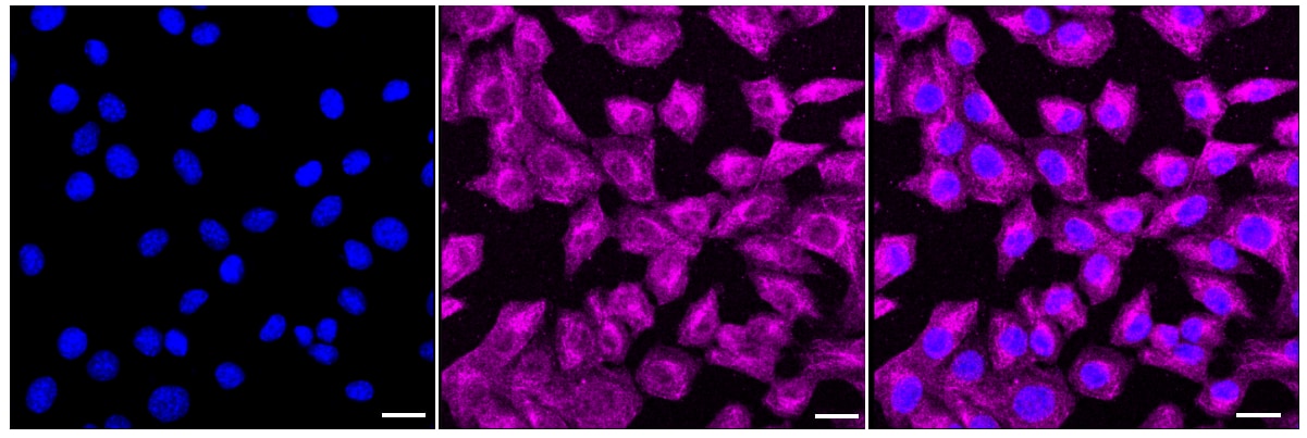 ERK1/2 Antibody (23GB4510)