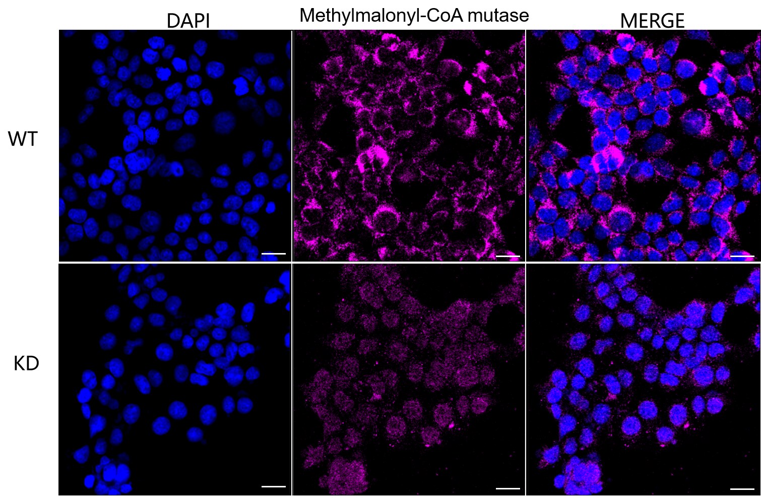 Methylmalonyl Coenzyme A mutase Antibody (23GB4550)