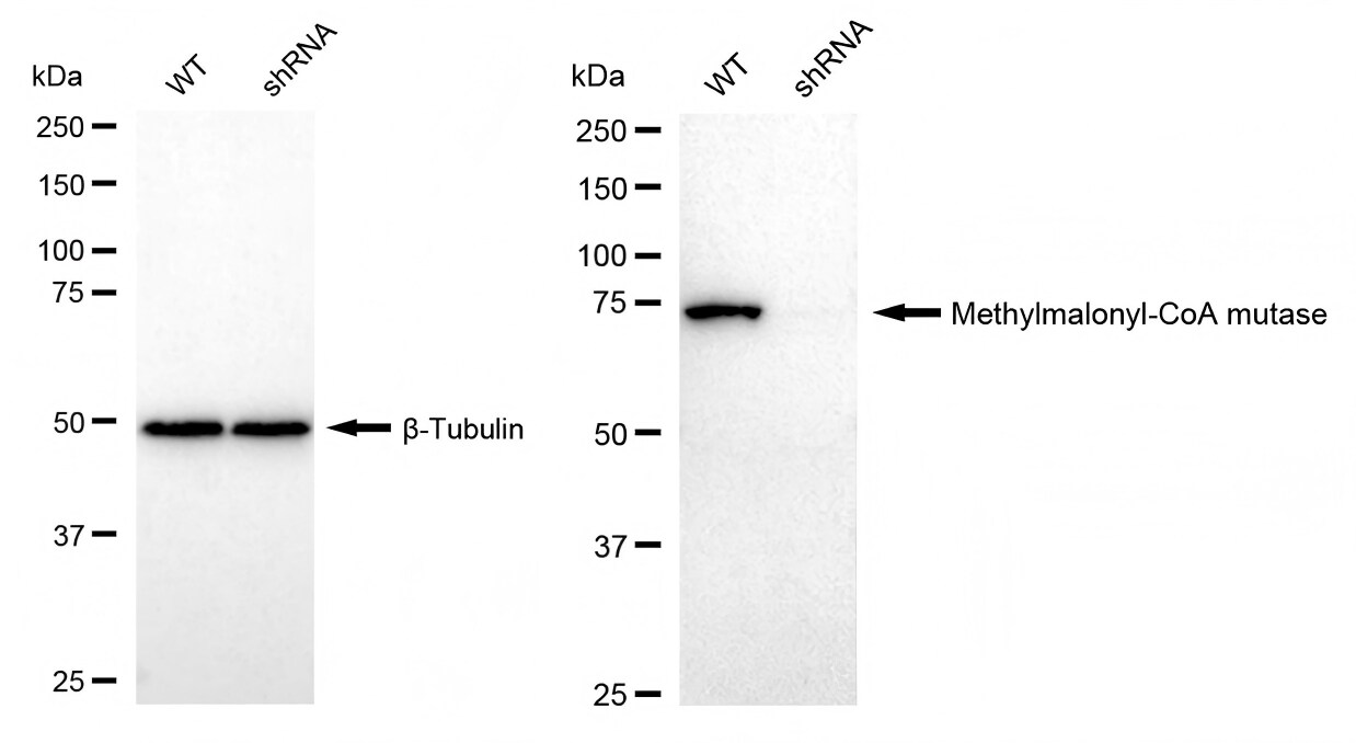 Methylmalonyl Coenzyme A mutase Antibody (23GB4550)