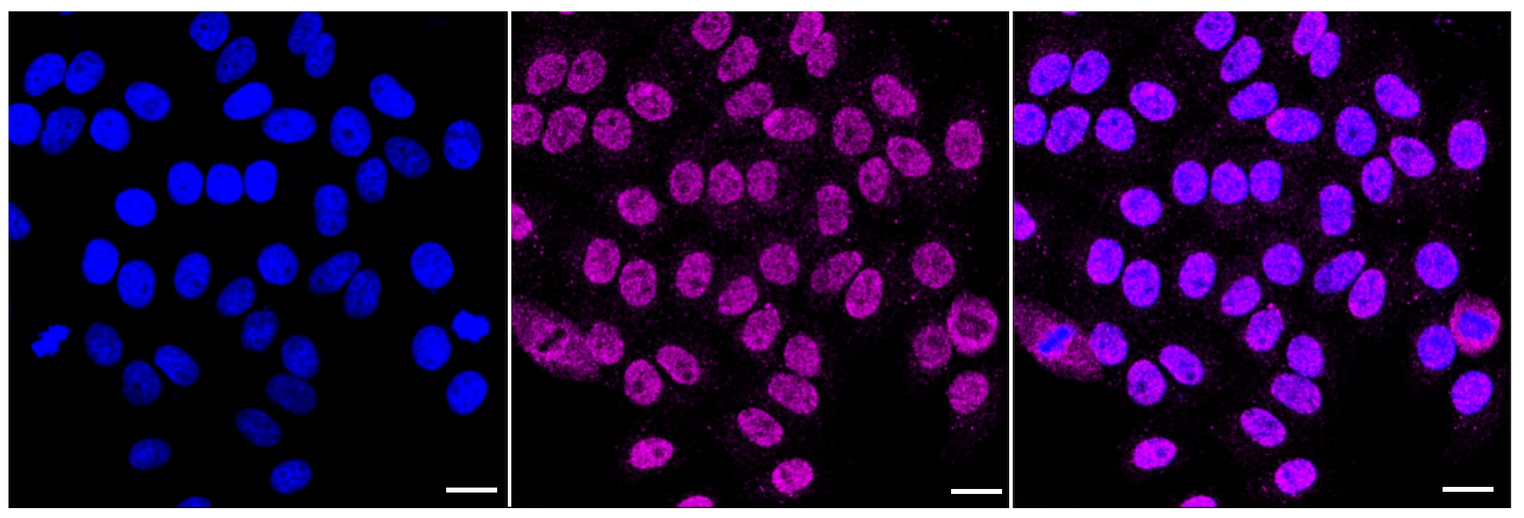 Methylmalonyl Coenzyme A mutase Antibody (23GB4555)