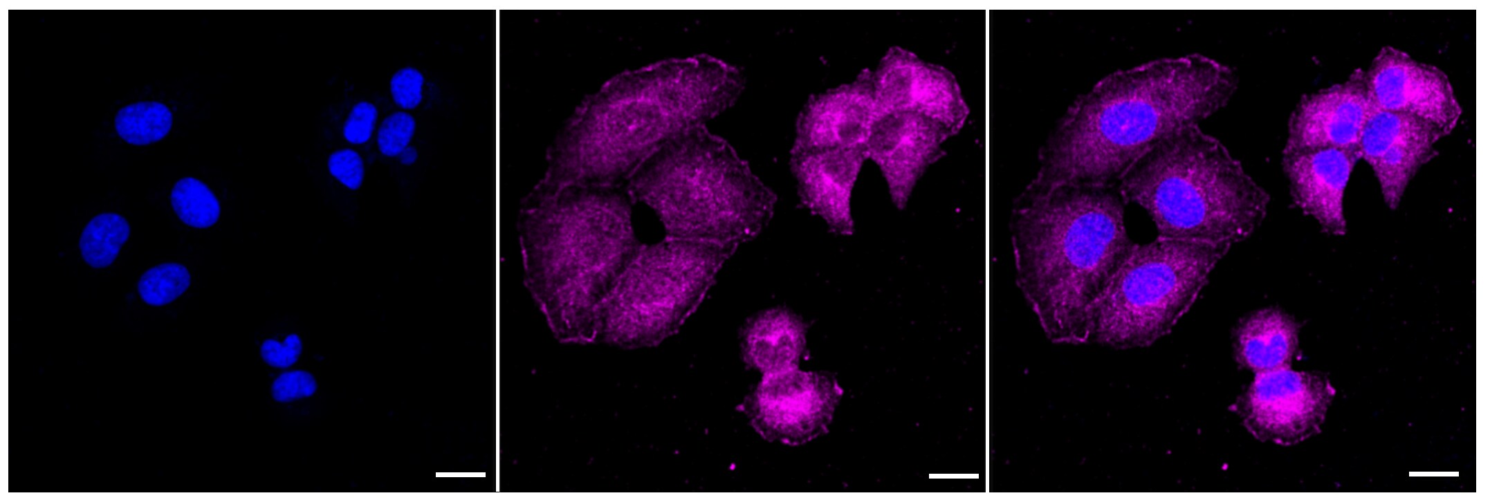 MTAP Antibody (23GB4560)