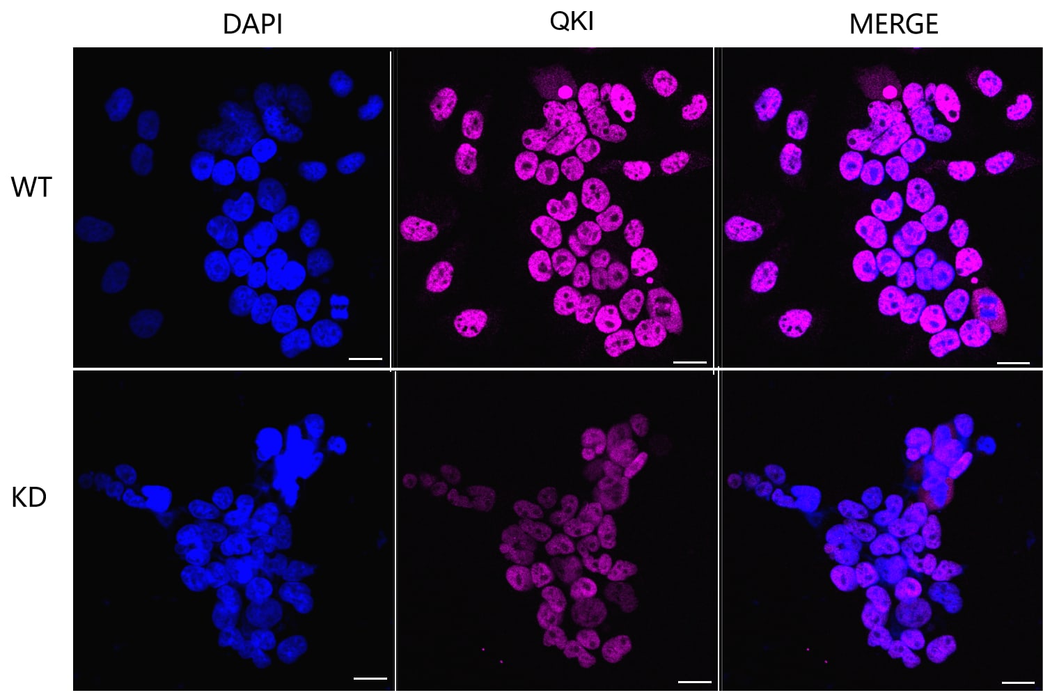 QKI/Quaking Antibody (23GB4595)