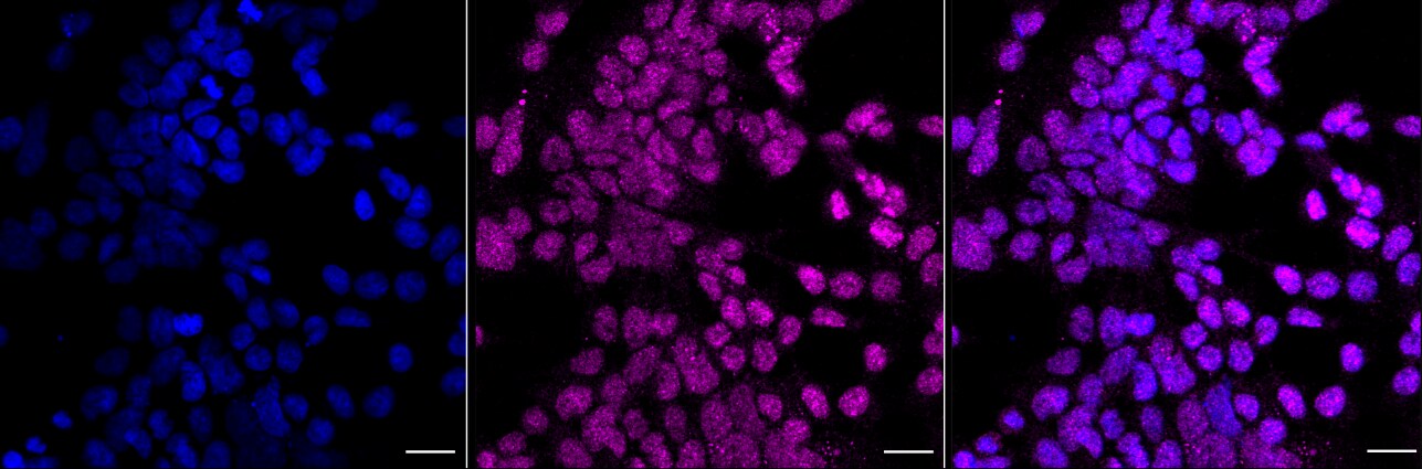Rad51 Antibody (23GB4600)
