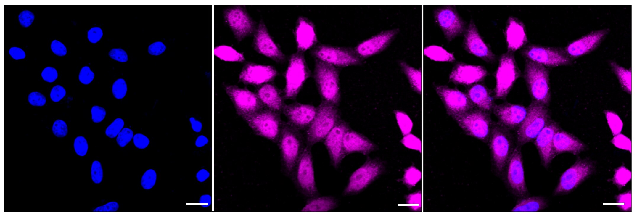 Spermine synthase Antibody (23GB4640)