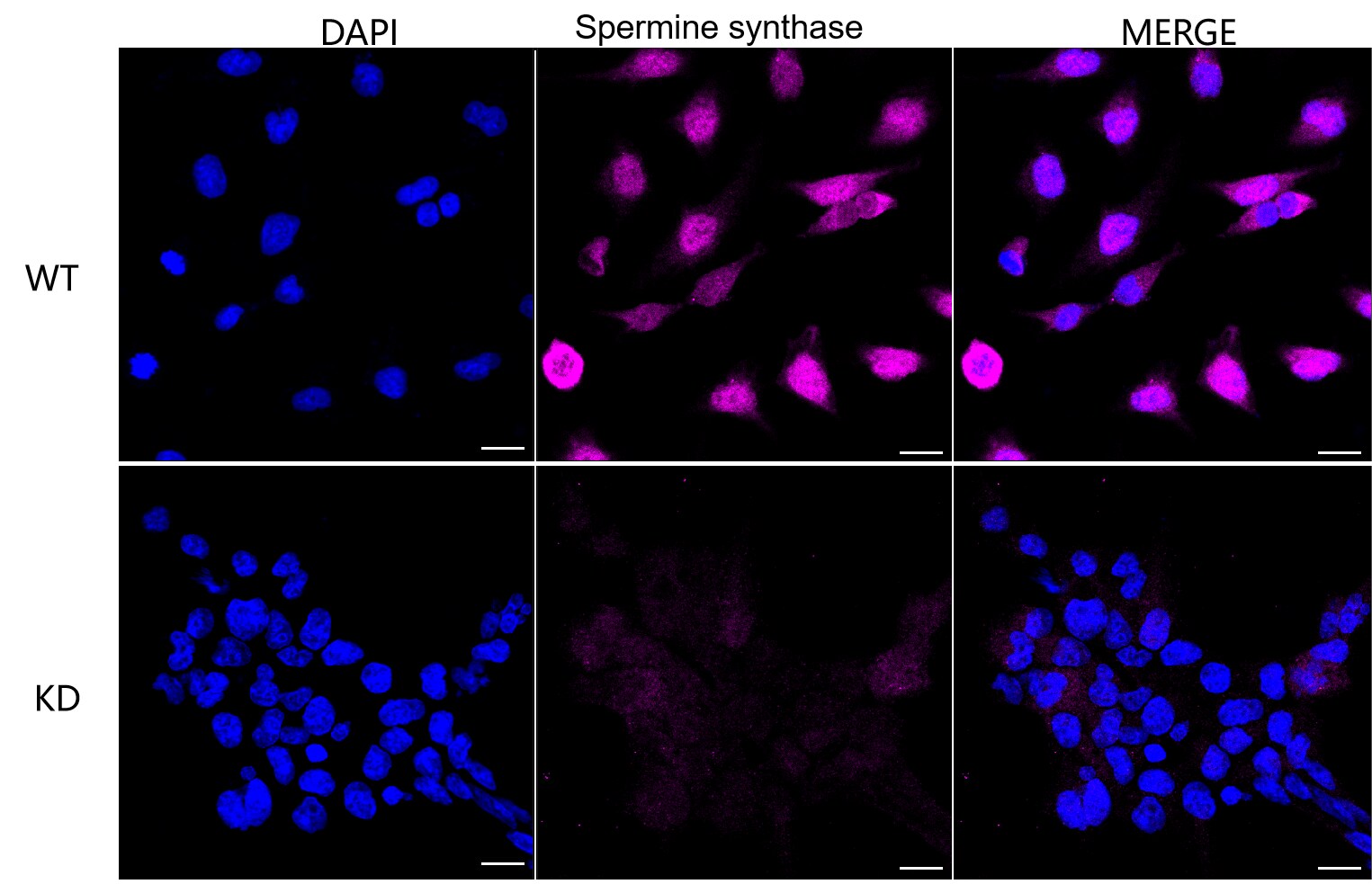 Spermine synthase Antibody (23GB4640)