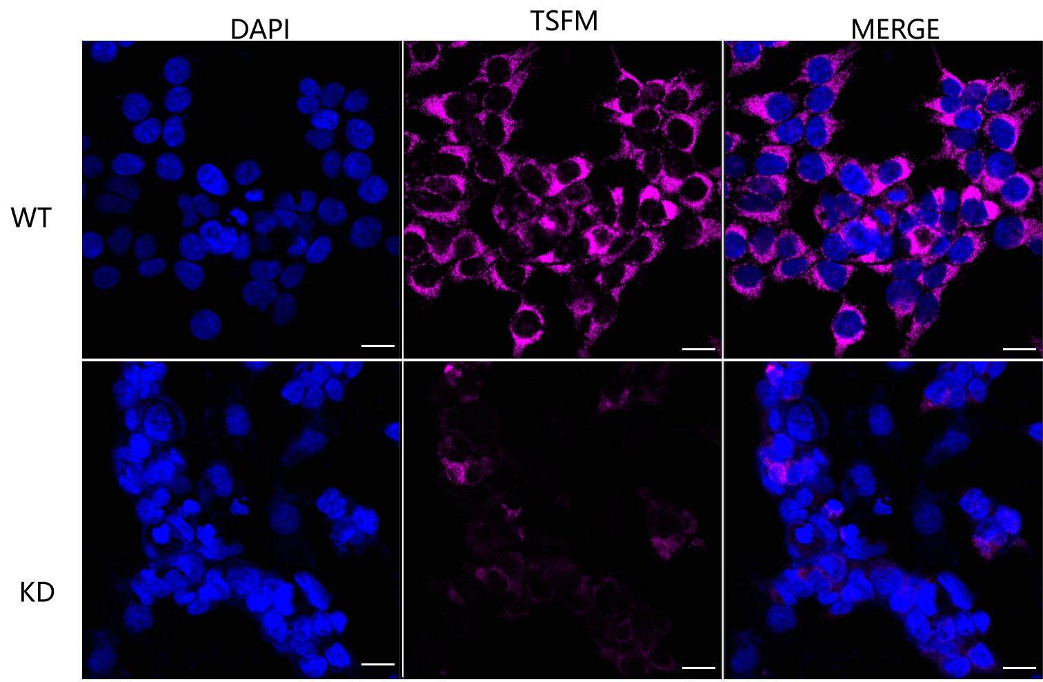 TSFM Antibody (23GB4710)