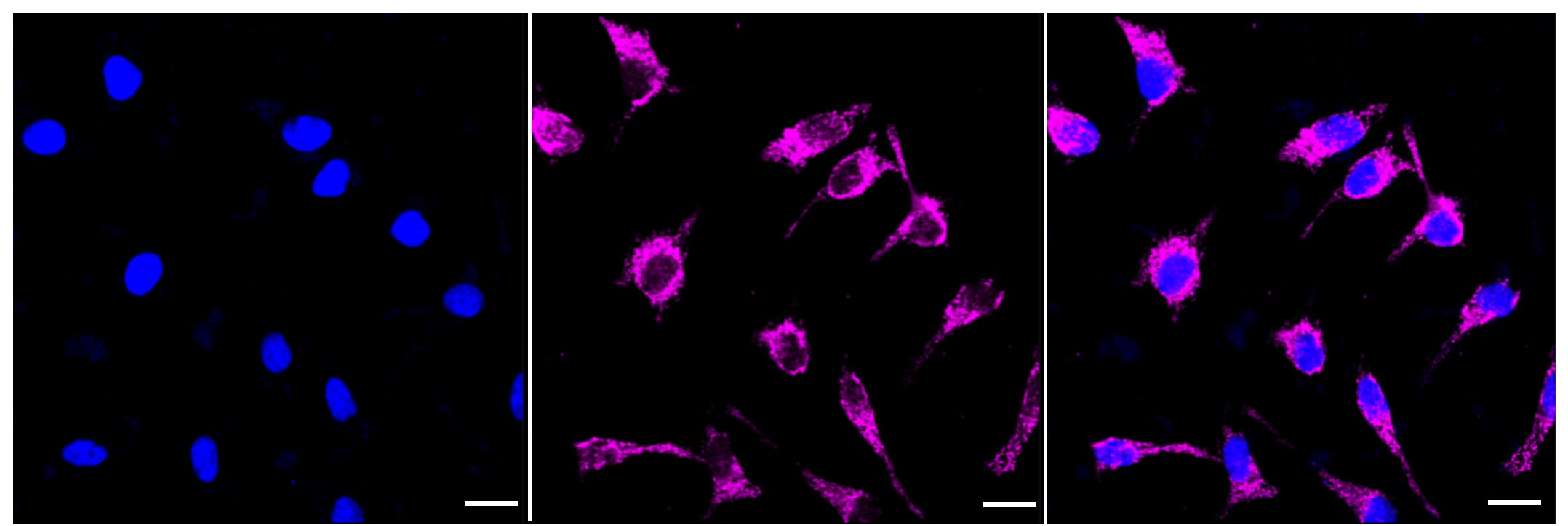 TSFM Antibody (23GB4710)