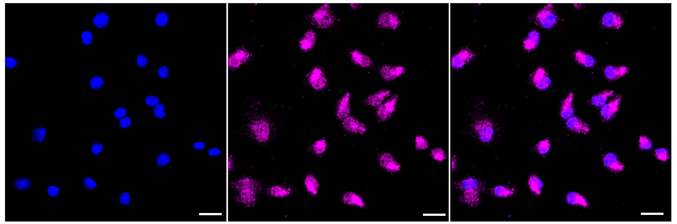 TDP-43/TARDBP Antibody (23GB4730)