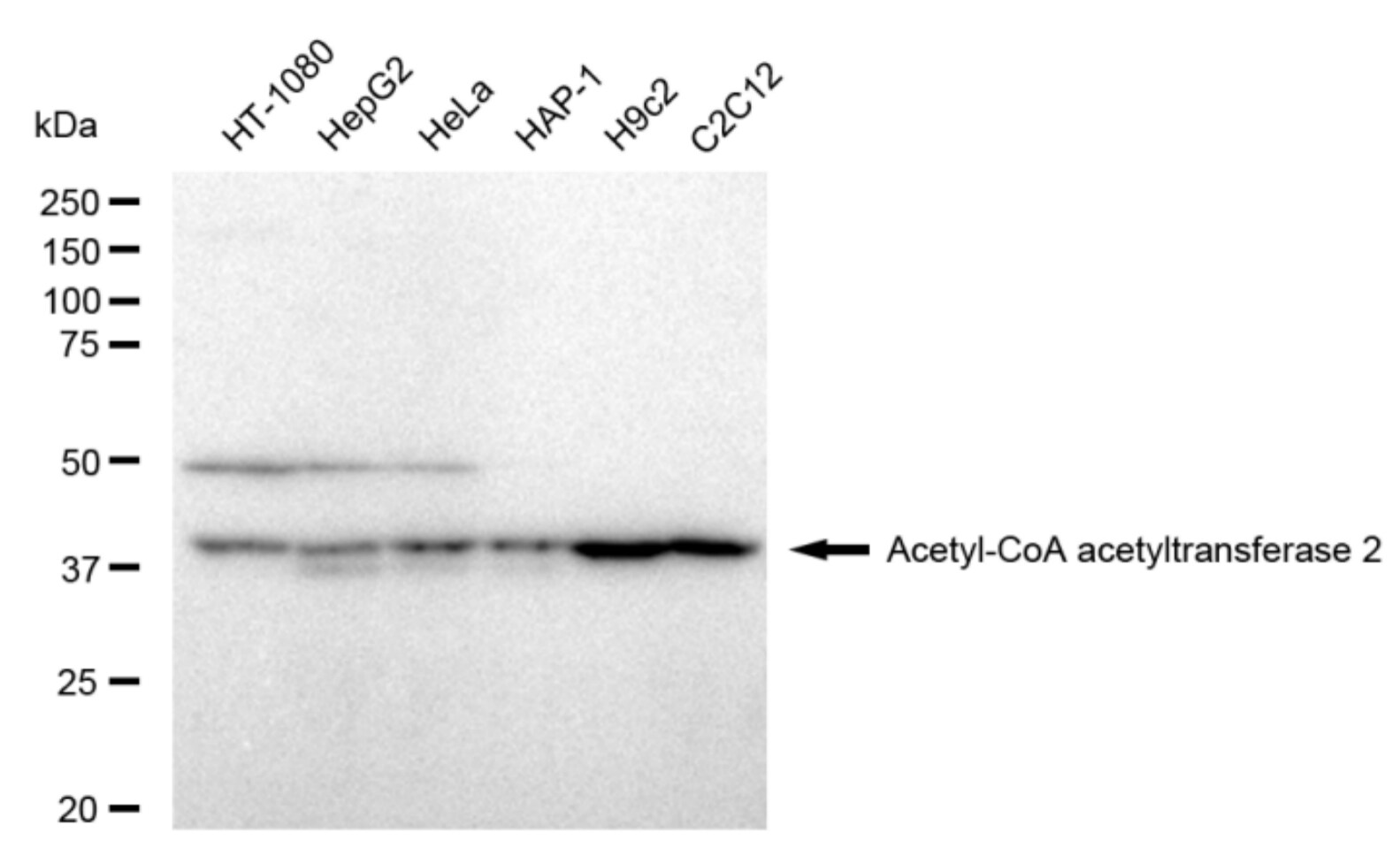 ACAT2 Antibody (23GB4745)