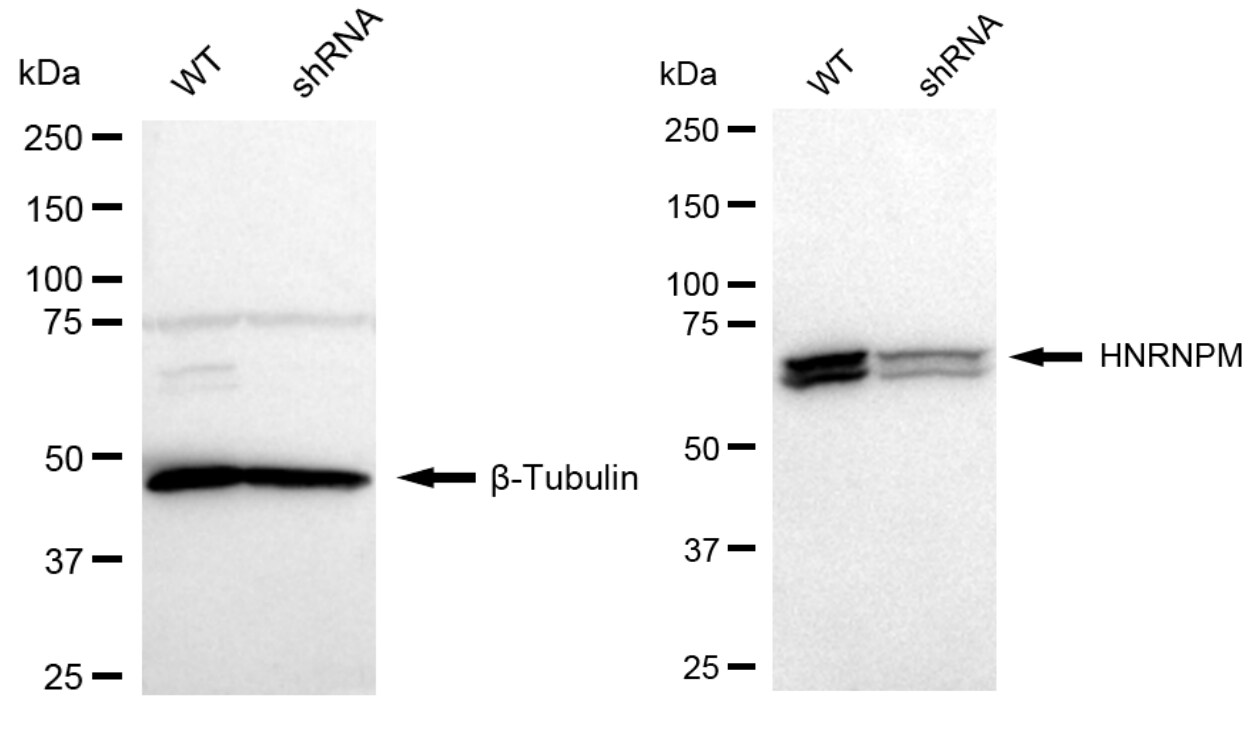 hnRNP M Antibody (23GB4895)
