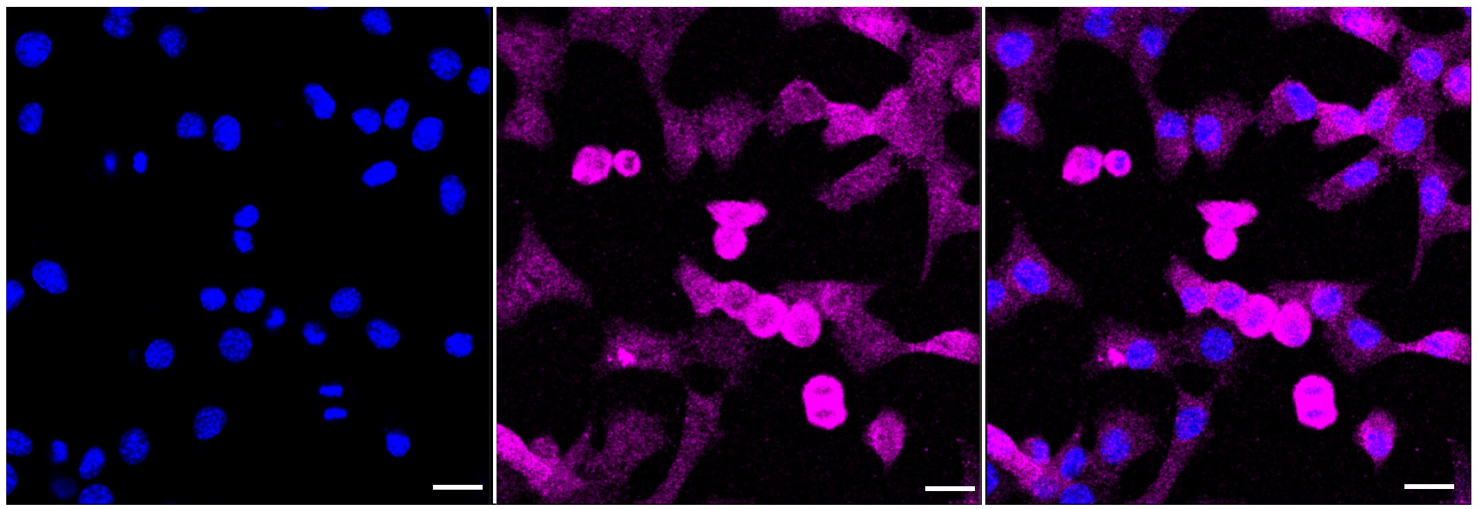 Galectin-3 Antibody (23GB4780)