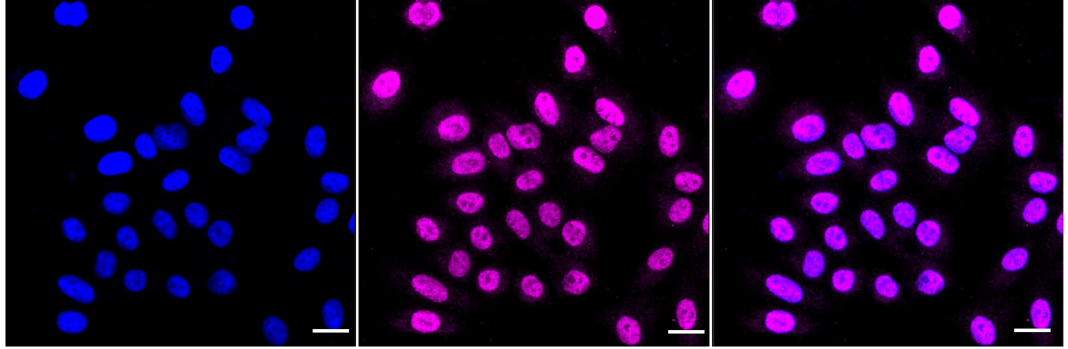 RPA70 Antibody (23GB4885)